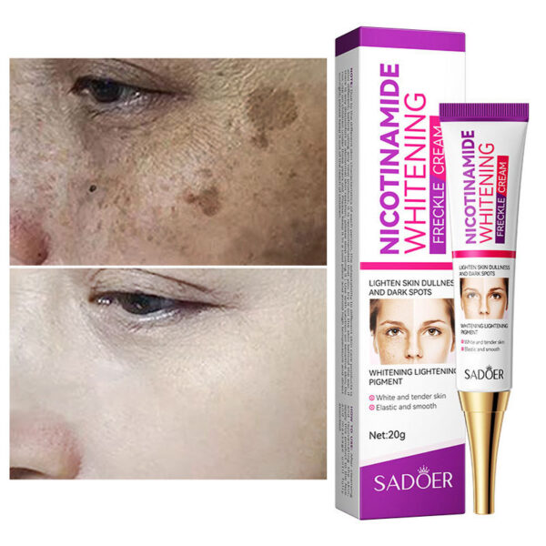 nicotinamide whitening freckles cream remove melasma dark spot acne marks lightening melanin brightens skin tone face skin care - Image 12