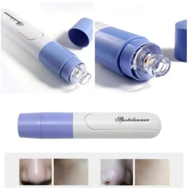 new electric blackhead remover sucker black head pimple pore cleaner vacuum blackhead remover pore cleaner (random color) - Image 6