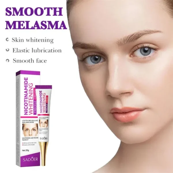 nicotinamide whitening freckles cream remove melasma dark spot acne marks lightening melanin brightens skin tone face skin care - Image 9