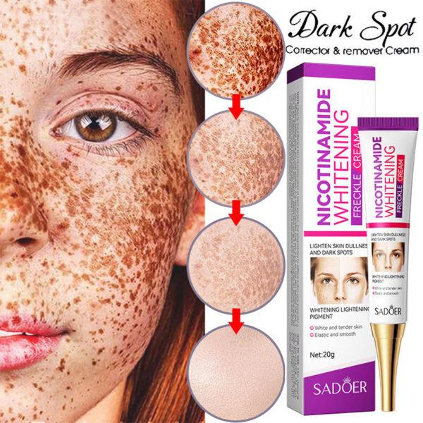 nicotinamide whitening freckles cream remove melasma dark spot acne marks lightening melanin brightens skin tone face skin care