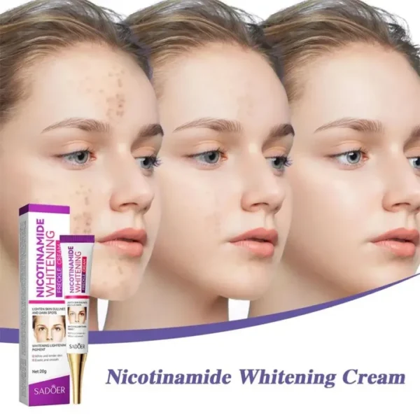 nicotinamide whitening freckles cream remove melasma dark spot acne marks lightening melanin brightens skin tone face skin care - Image 10