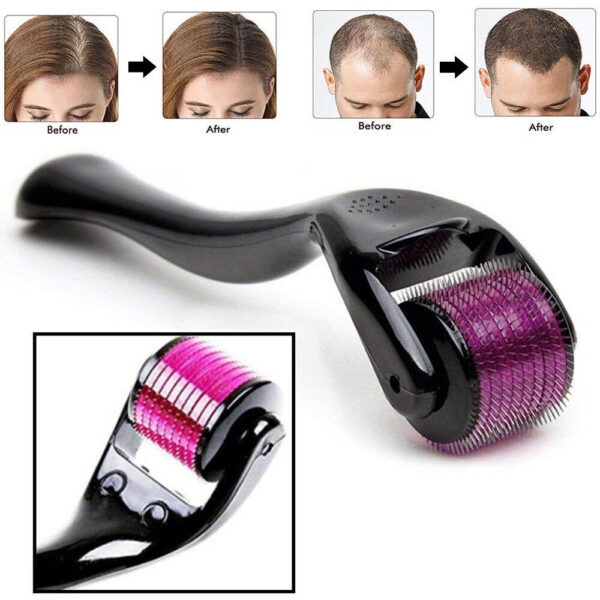 derma roller 0.5mm with 540 micro needle for hair growth and facial skin therapy| skin care beauty tool for anti-aging skin repair, for men and women - Image 4