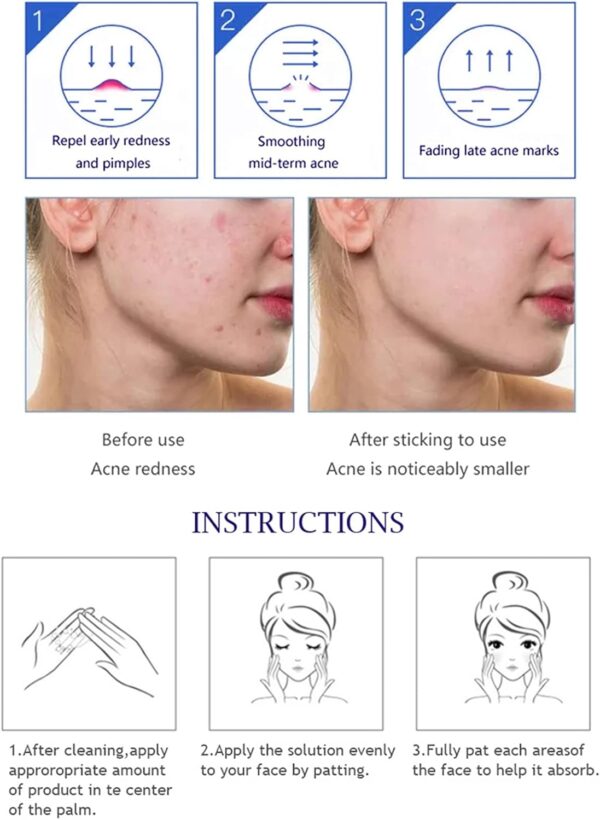 aichun beauty anti - acne whitening facial serum aloe vera extract salicylic acid repairs damaged skin | 30ml - Image 6