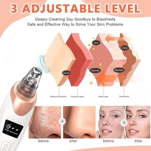 face vacuum blackhead remover pore cleaner | electric deep cleansing tool for nose & face - Image 3