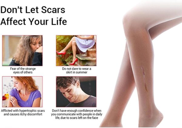 acne scar removal rejuvenation serum | scar, c section & stretch mark removal oil for women - Image 5