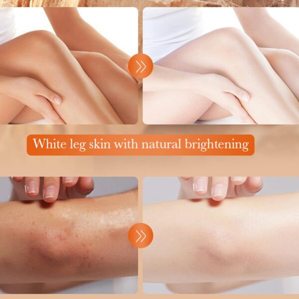 sadoer 7days vitamin c whitening dark knuckle black knee cream niacinamide vitamin c dark spot corrector remover 140g - Image 7