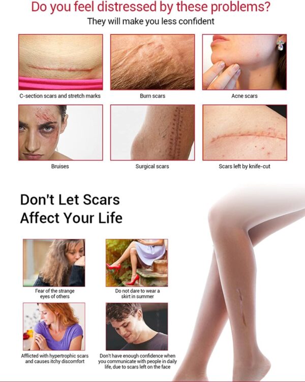 aichun beauty scar removal facial serum pimples stretch marks face moisturizing body remove scars kojic acid | vitamin - e | 30ml - Image 3