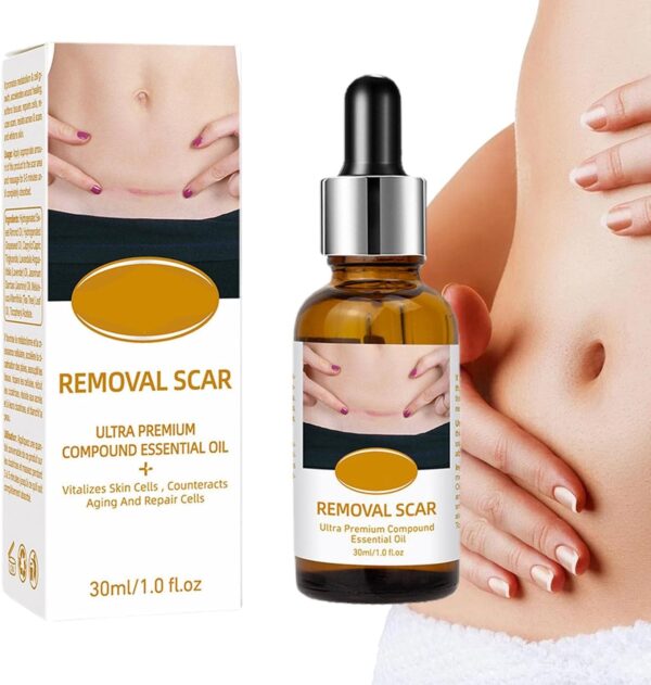 acne scar removal rejuvenation serum | scar, c section & stretch mark removal oil for women