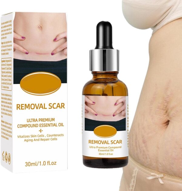 acne scar removal rejuvenation serum | scar, c section & stretch mark removal oil for women - Image 8
