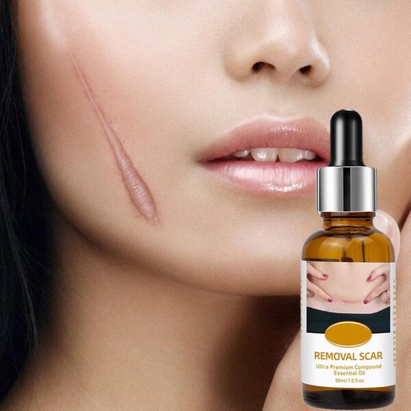 acne scar removal rejuvenation serum | scar, c section & stretch mark removal oil for women - Image 7