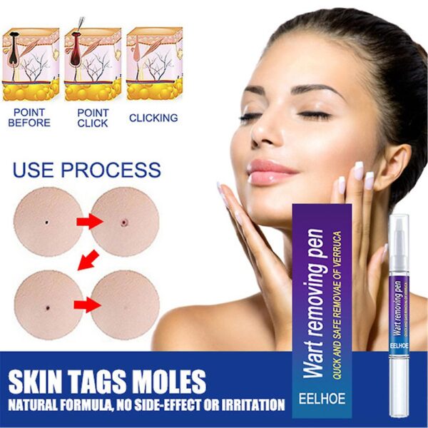 warts remover original cream wart removal ointment wart treatment skin tag mole remover antibacterial foot wart