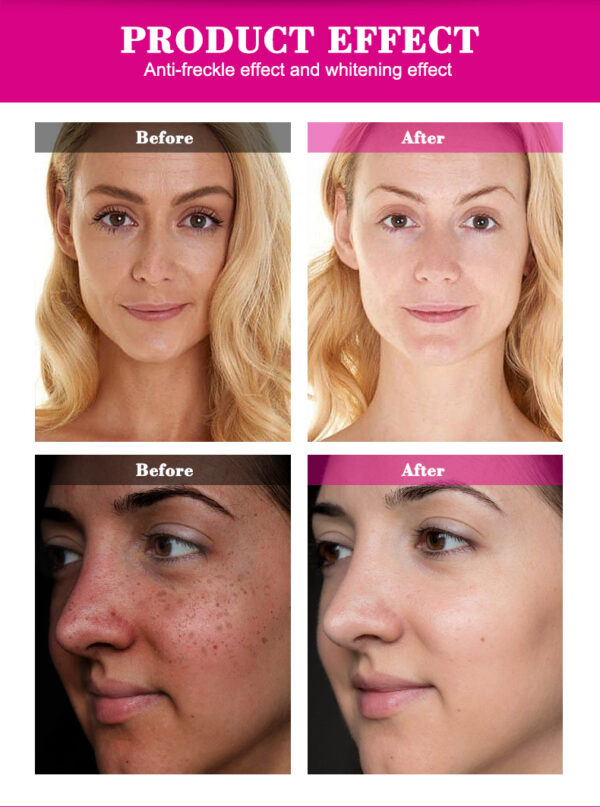 aichun beauty moisturizing natural bright skin care whitening cream  | best cream for all types of skin | 80ml - Image 10