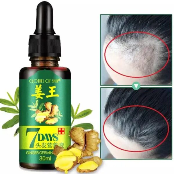 original 7 days hair growth germinal serum oil (30ml) - Image 4