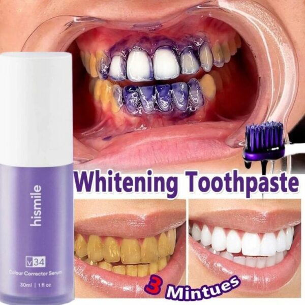 teeth brightening hismiles v34 colour corrector serum - Image 6