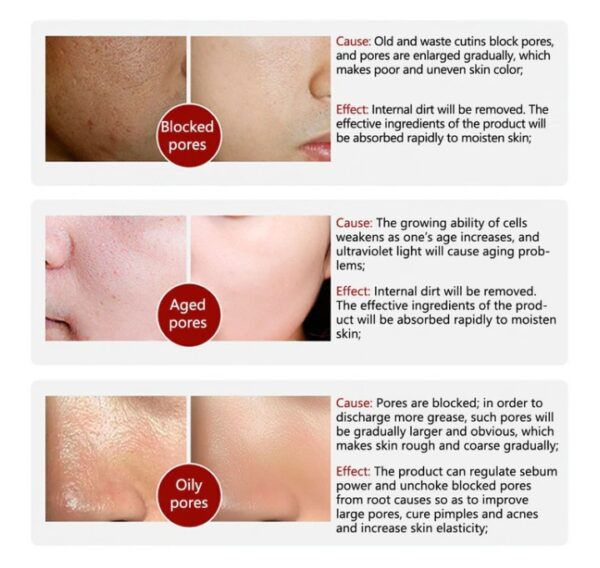 rorec moisturizing anti wrinkle rice face serum for open pores 15ml - Image 3
