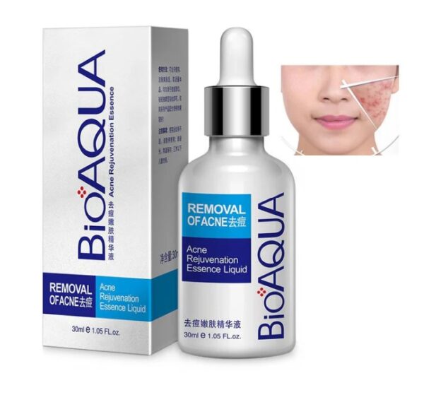 bioaqua anti-acne serum removal of acne essence liquid 30ml - Image 2