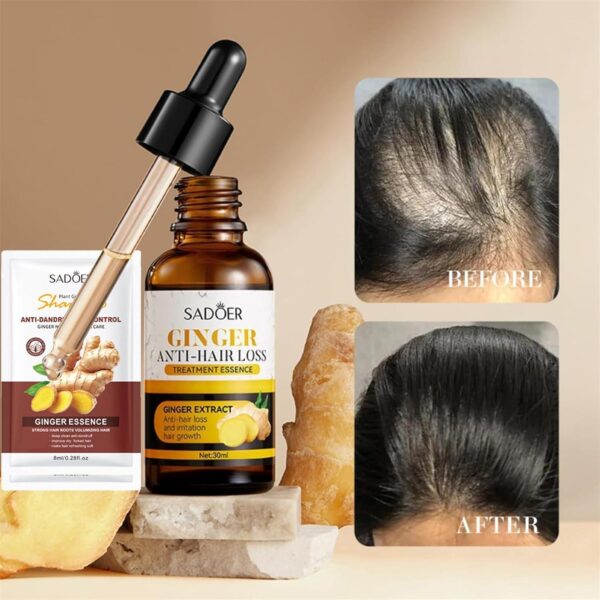 sadoer ginger anti-hair loss treatment essence 30ml - restores hair, promotes growth - Image 6