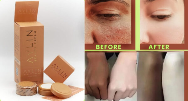 aylin beauty cream best cream ever | best quality cream |  aylin beauty cream for face acne pimples, & blackheads | whitening cream ( original ) - Image 3