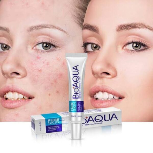 bioaqua anti acne cream acne scar removal cream | best quality scar removal cream 30g( original ) - Image 5