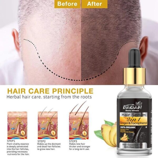 anti hair loss serum 2 in 1 natural hair fall serum ginger and tocopherol hair growth essence oil hair care serum | hair loss treatment for men & women |