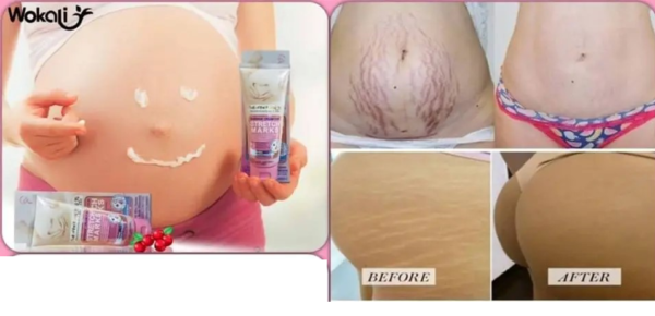 fruit of the wokali maternity stretch marks cream 130ml for all skin type | best cream - Image 6