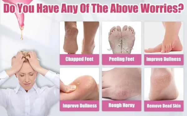 silicone socks gel moisturizing jelly socks foot care protector (random color)  75gm - Image 6