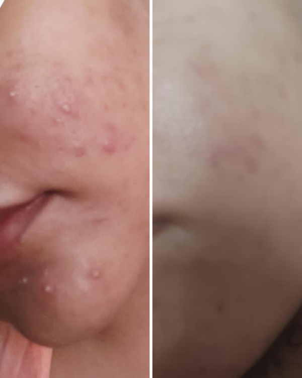 nirvana botanics vitamin c + e serum - 15ml | anti acne & glowing serum vitamin c + e - Image 3